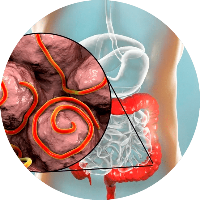 Γαστρεντερική οδός και παράσιτα