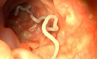 Αιτίες παρασίτων στον ανθρώπινο οργανισμό